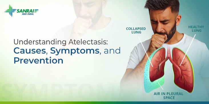 Understanding Atelectasis: Causes, Symptoms, and Prevention